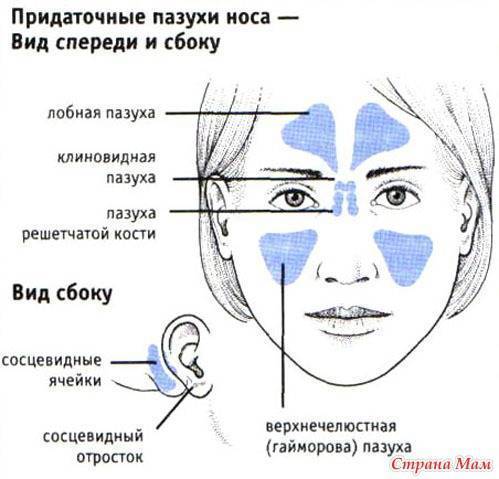 Можно ли вылечить гайморит без антибиотиков и как это сделать