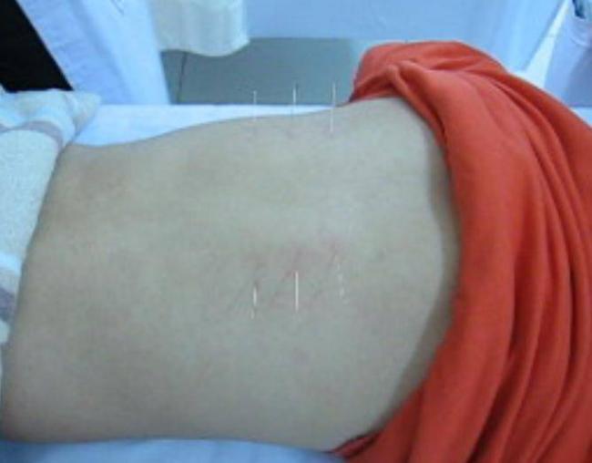 Почему возникает боль в копчике?