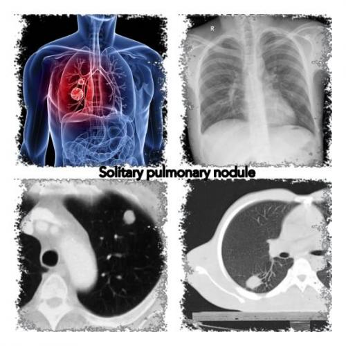 Помогите с расшифровкой кт легких ребенка