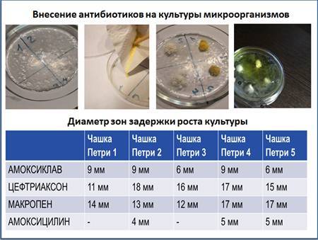 14 природных антибиотиков, которые отлично борются с инфекциями