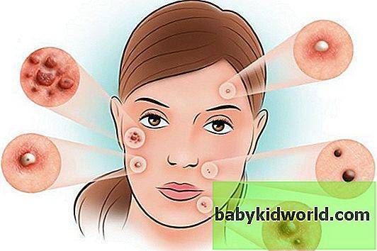 Радевит - инструкция по применению, отзывы, аналоги и формы выпуска мазь или крем лекарства для лечения экземы, псориаза, морщин у взрослых, детей и при беременности. Состав