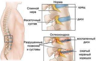 Причины боли в левом боку со стороны спины