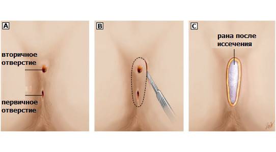 Почему возникает боль в копчике у мужчин: диагностика и лечение