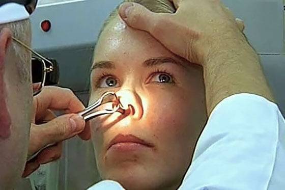 В носоглотке густая слизь: причины, лечение, профилактика