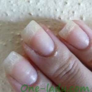 Почему слоятся ногти и что с этим делать?