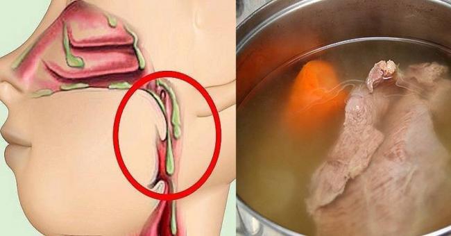 Как избавиться от слизи в горле – 10 самых эффективных способов