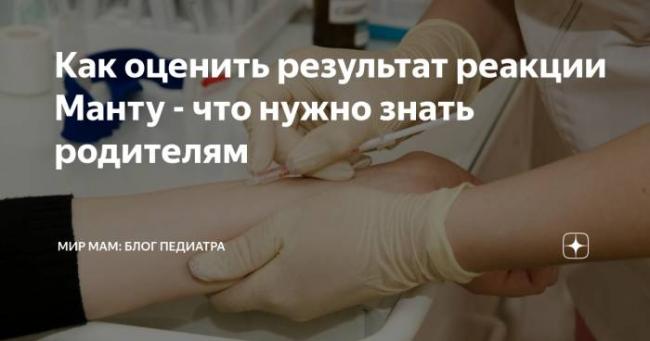 Оценка результатов диаскинтеста у взрослых и что делать если положительный у ребенка