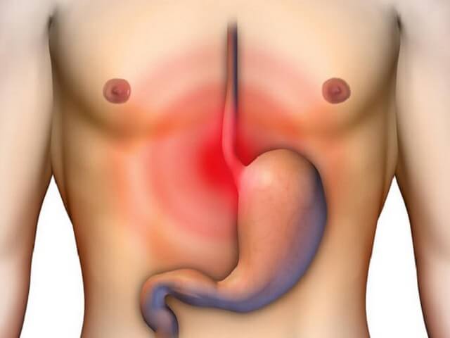 Коварная бактерия хеликобактер пилори, основные симптомы и лечение хеликобактериоза