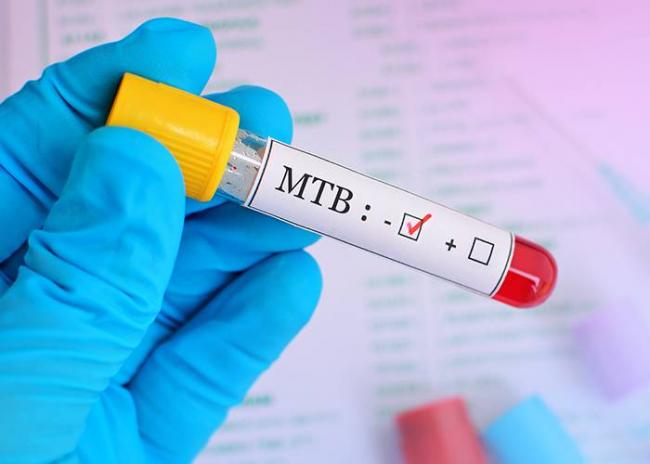 Манту или диаскинтест (есть случаи смерти) что безопаснее?