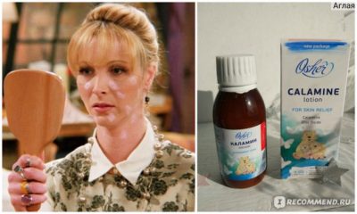 Мазь циндол при ветрянке у детей