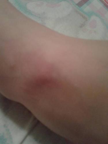 Болит копчик, когда сидишь или встаешь: причины и лечение