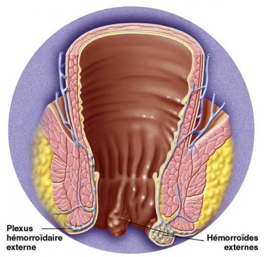 Свечи с облепиховым маслом