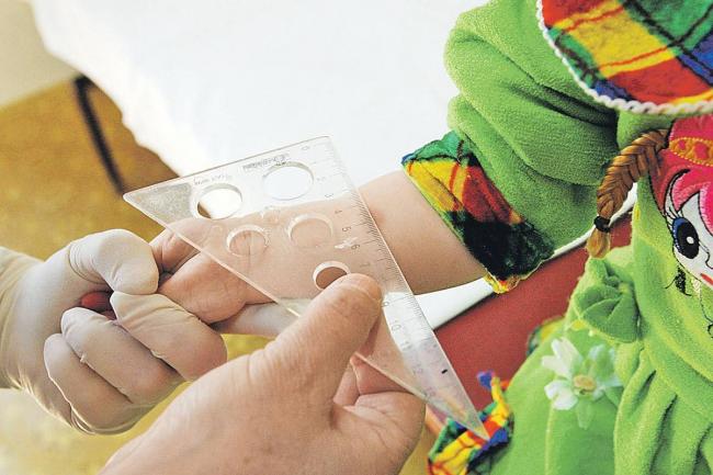 Аллергия на манту