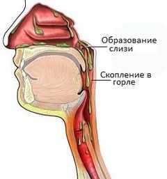 Скапливается слизь в носоглотке: как избавиться, причины и лечение народными средствами