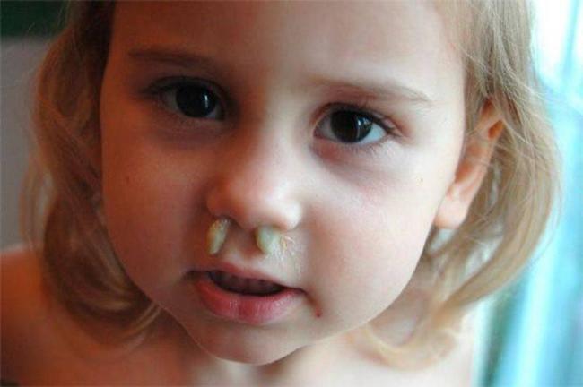 Почему образуются сопли коричневого цвета и что они означают