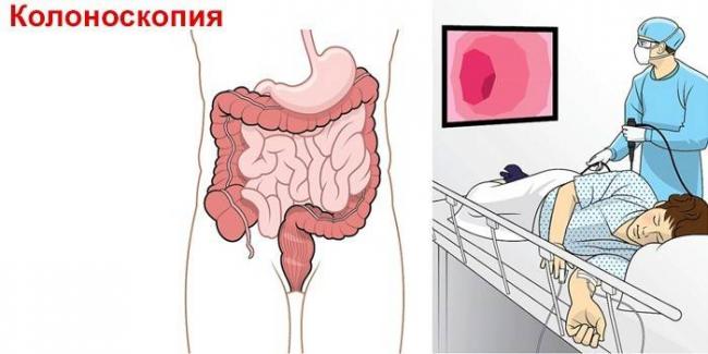 Болит копчик: причины боли, что делать при кокцигодинии, симптомы и лечение