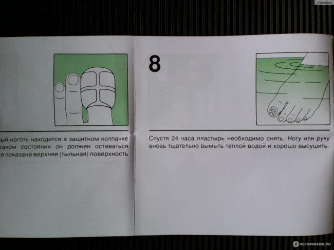 Микоспор набор – инструкция по применению, цена, отзывы, аналоги