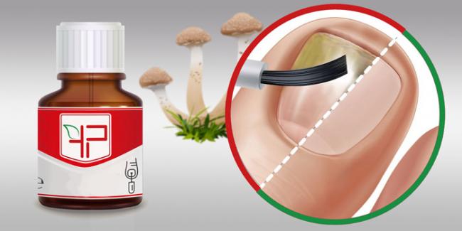 Препарат микоспор: инструкция по применению