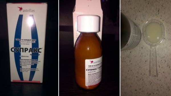 Цефтриаксон при пневмонии: сколько дней колоть, дозировка