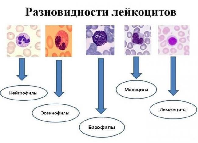 Эозинофилы в крови повышены, какая норма, причины увеличения результата анализа у детей, взрослых