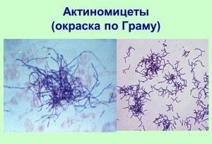 Азот почвы. круговорот азота в природе. биологическое связывание азота микробами-азотфиксаторами