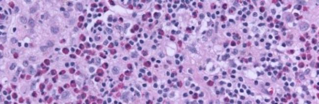 Эозинофилы у ребенка. норма, почему повышены, отсутствуют, понижены в крови. причины