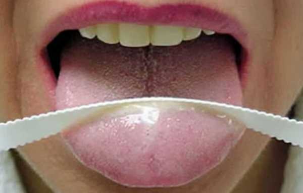 Как избавиться от комка слизи в глотке