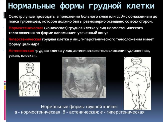 Грудная клетка неправильной формы