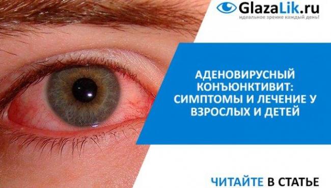 Лучшие глазные мази от конъюнктивита – обзор 14 наименований