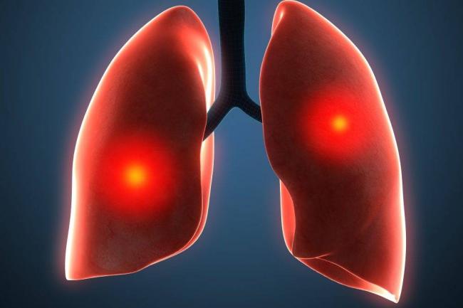 Сильная боль в горле и грудной клетке при кашле