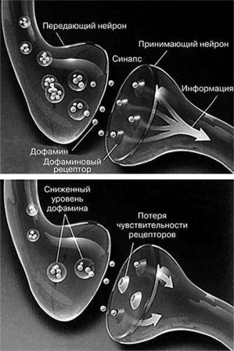 Застойная пневмония при сердечной недостаточности