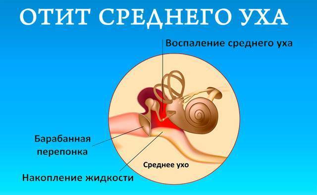 Скапливается слизь в носоглотке: как избавиться, причины и лечение народными средствами