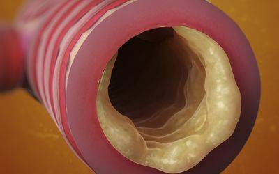 Сопли в горле у взрослого - что делать, как избавиться