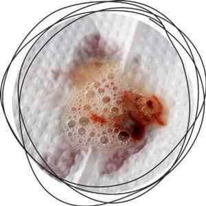 Причины коричневой мокроты