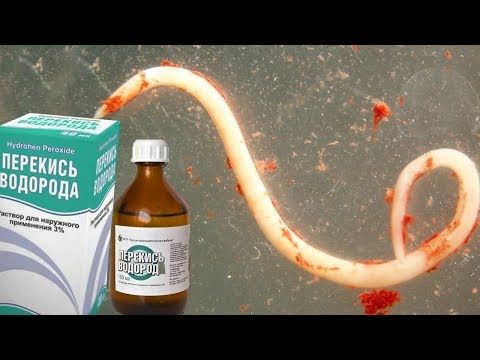 Как избавиться от паразитов: лучшие народные средства