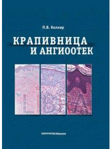 Лечение отека квинке: симптомы и причины, фото болезни