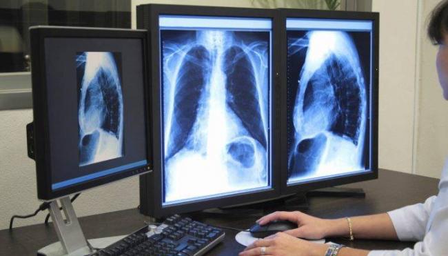 Очаги на кт легких