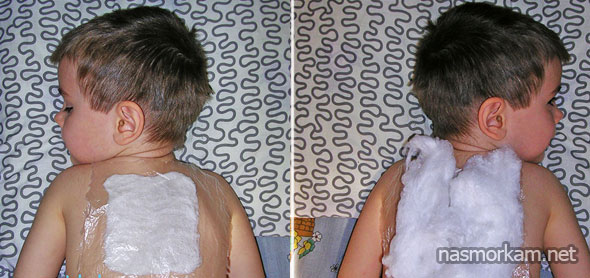 Компресс из меда от кашля для детей