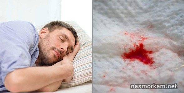 Кровь в мокроте, появляющаяся при отхаркивании