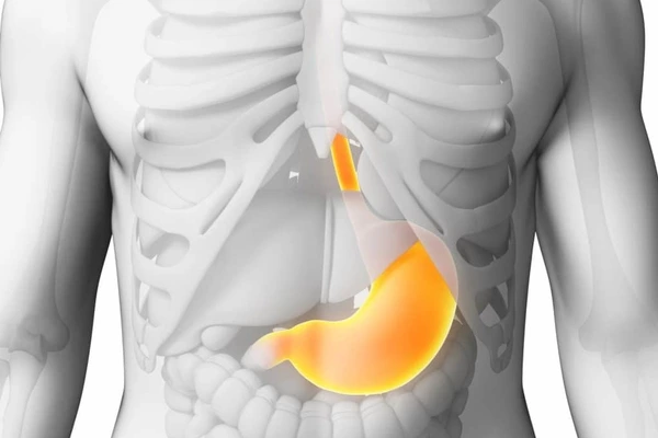 Дуодено-гастральный рефлюкс: что это такое, причины, симптомы, диагностика и лечение (диета, препараты, народные средства)