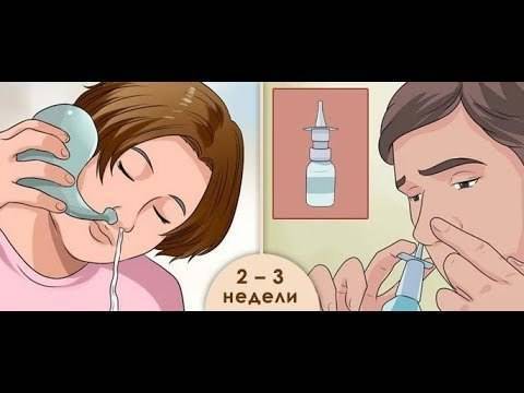 Можно ли в баню с гайморитом? позаботьтесь о своем здоровье заранее