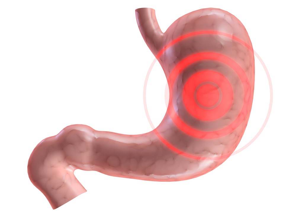 Рацион и правила диеты при язвенной болезни 12-перстной кишки