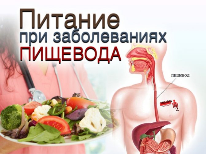 Гастроэзофагеальный рефлюкс: симптомы, лечение и диета