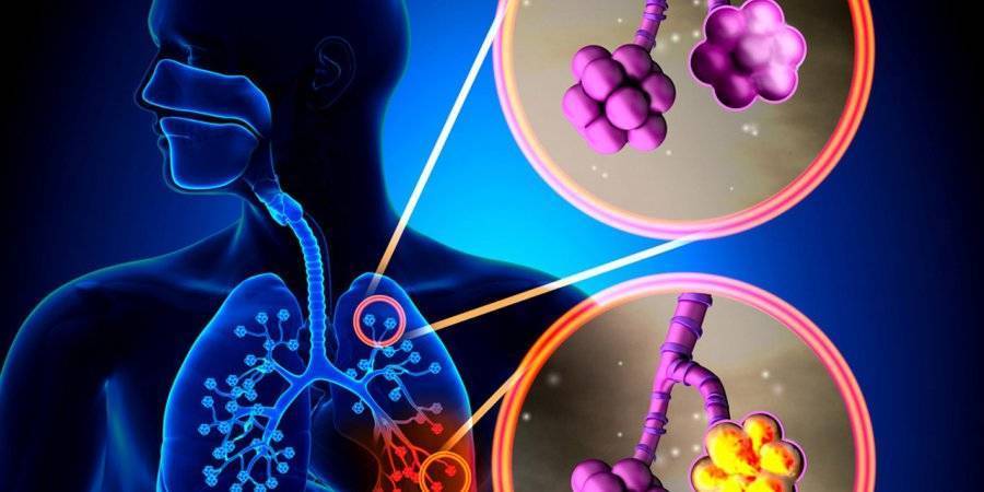 Флуимуцил таблетки - официальная инструкция по применению