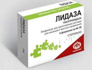 Ронидаза : инструкция по применению