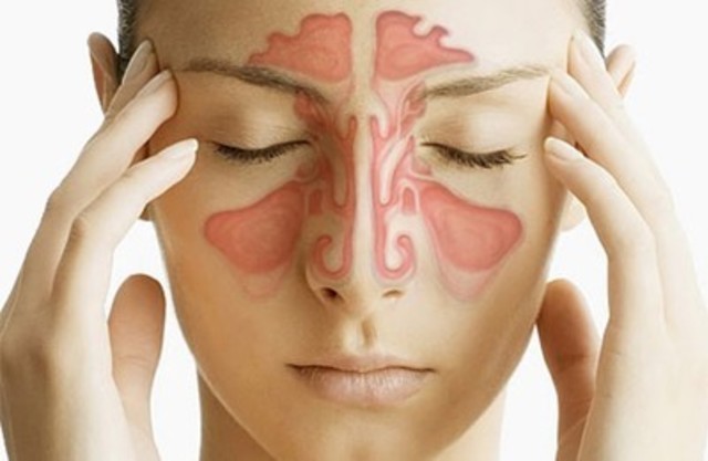 Можно ли греть нос при гайморите (синусите) в домашних условиях