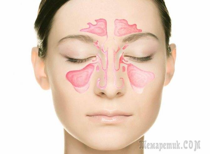 Польза и вред прогревания при гайморите