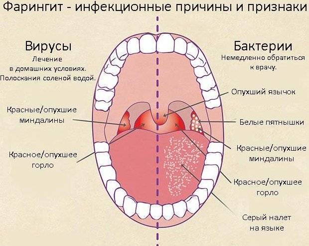 Люголь для горла инструкция по применению
