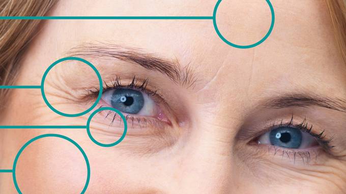 Возрастной дефицит объема на лице