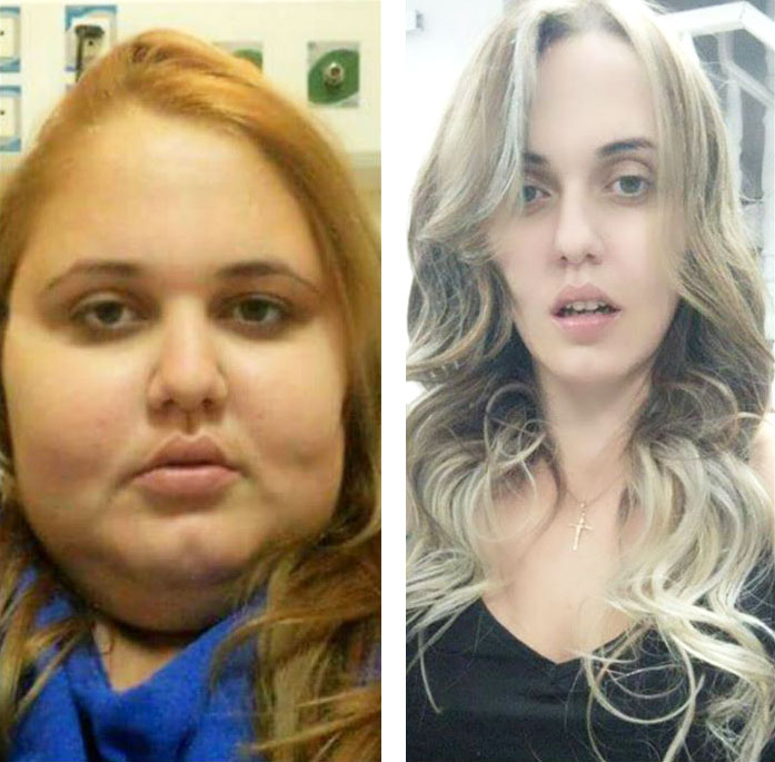 Как объем лица связан с возрастом